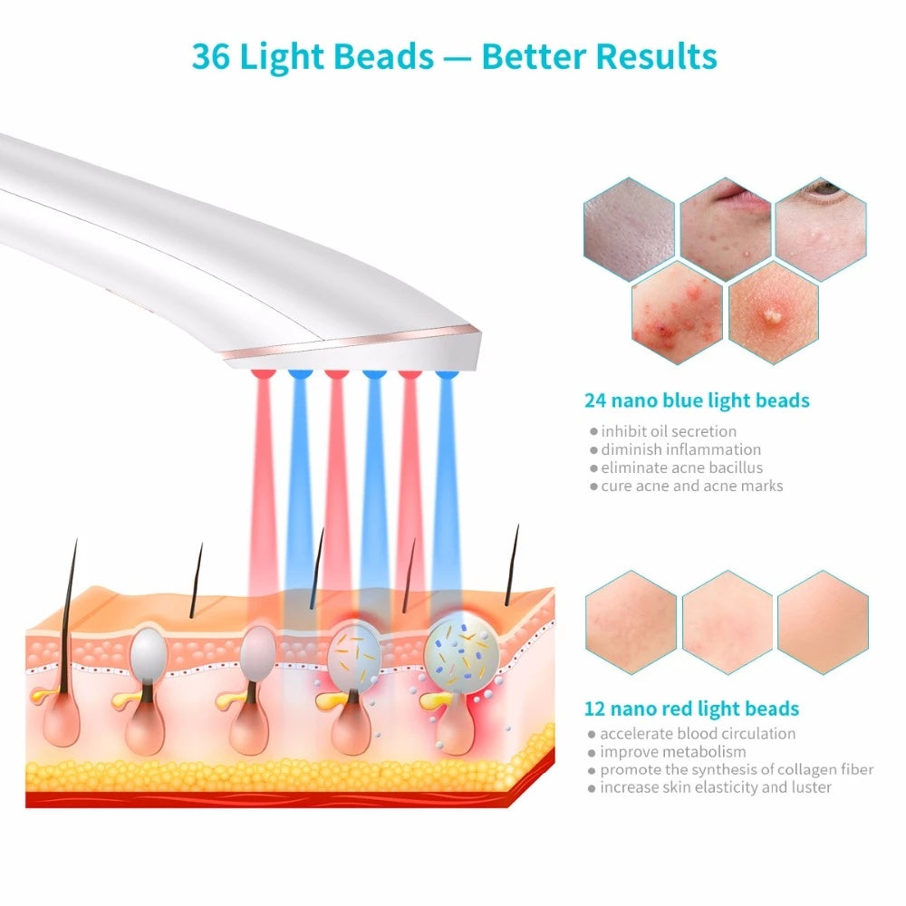 Acne Light Therapy Xpreen Wireless Rechargeable Light Acne Treatment Device Acne Clearing Eraser with Blue Light and Red Light - Abysaz Kollectionz