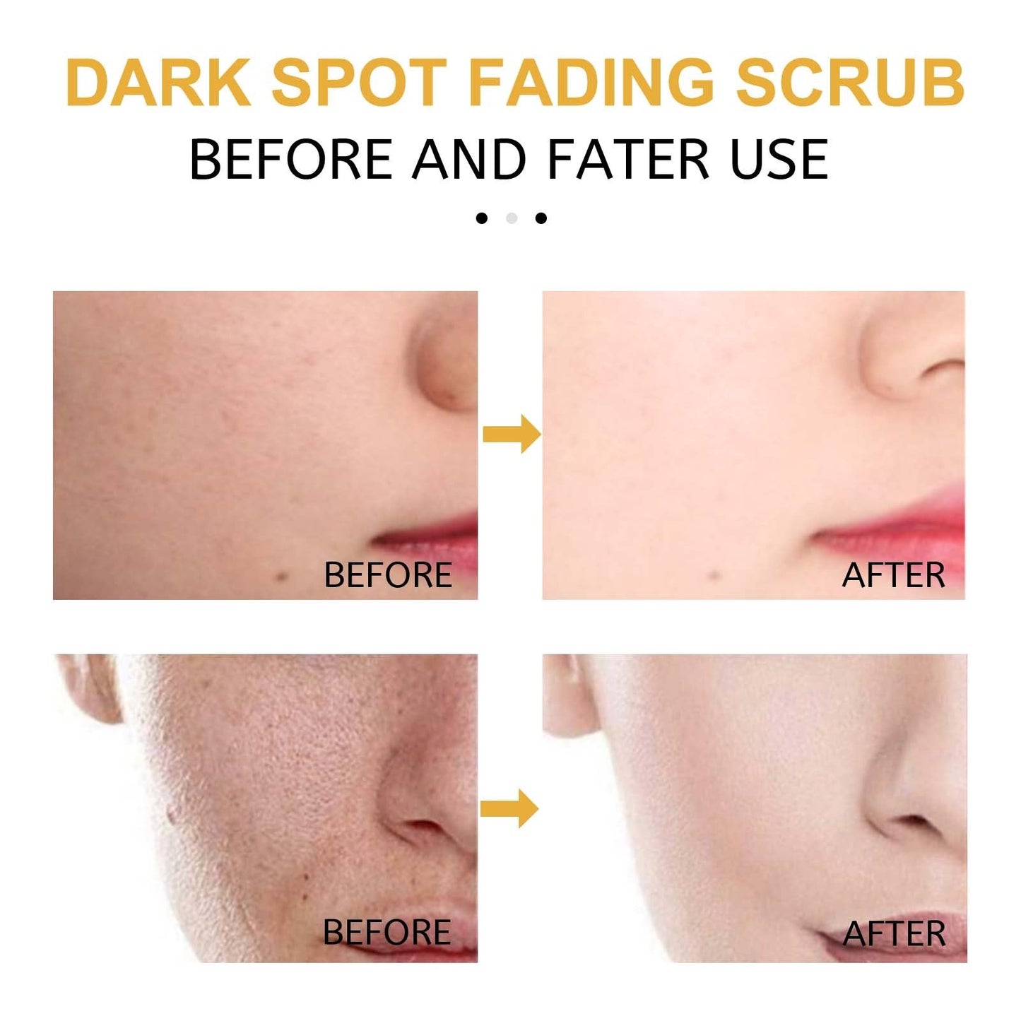Eelhoe Turmeric Exfoliating Facial Scrub For Deep Cleansing Of Delicate Pores And Beauty Cleansing Treatment Abysaz Kollectionz