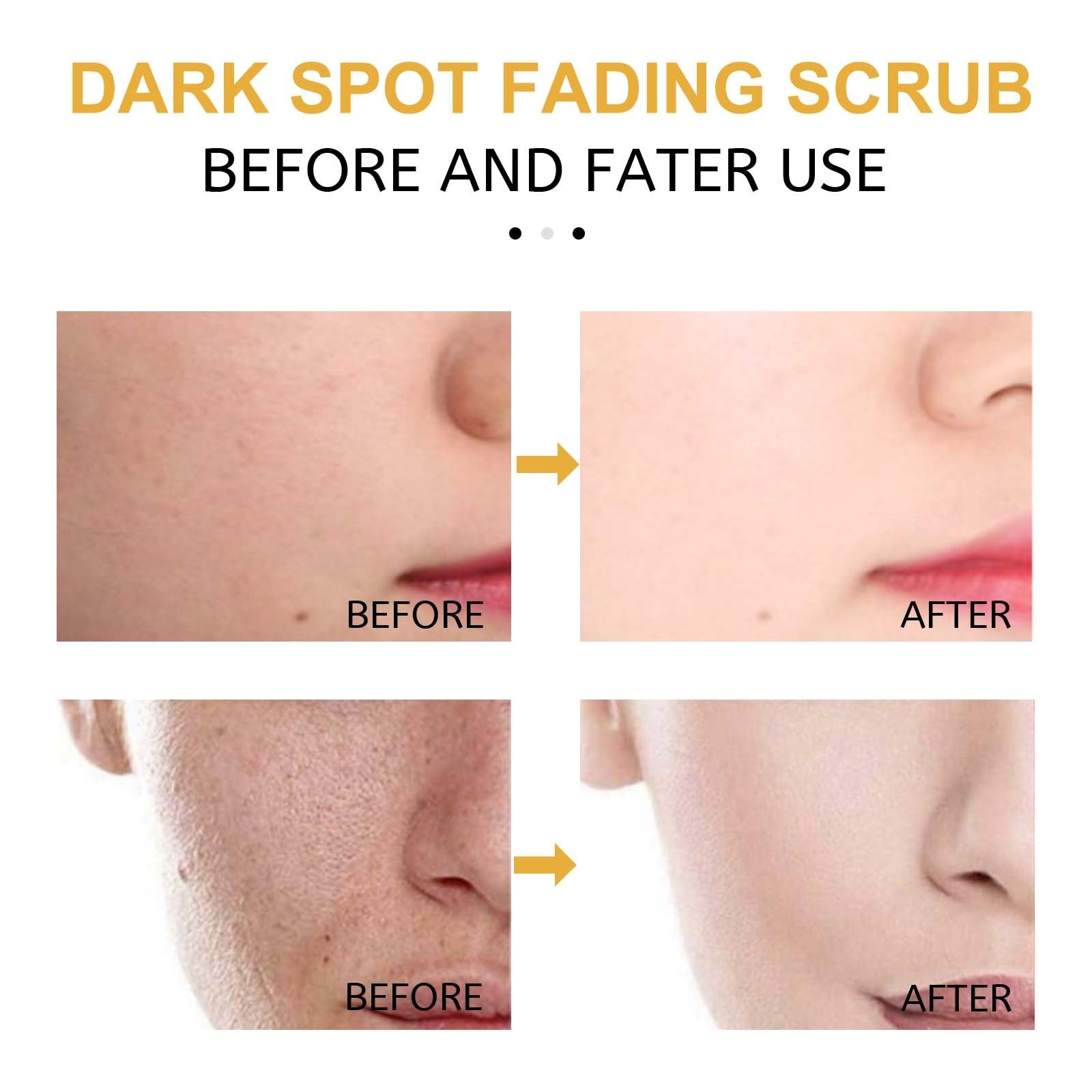 Eelhoe Turmeric Exfoliating Facial Scrub For Deep Cleansing Of Delicate Pores And Beauty Cleansing Treatment Abysaz Kollectionz