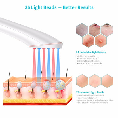 Acne Light Therapy Xpreen Wireless Rechargeable Light Acne Treatment Device Acne Clearing Eraser with Blue Light and Red Light - Abysaz Kollectionz